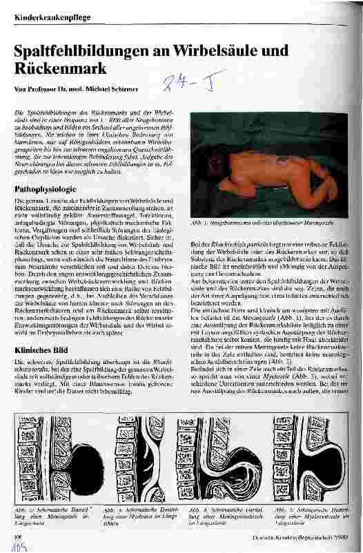 Vorschauseite 1: Spaltfehlbildungen an Wirbelsäule und Rückenmark