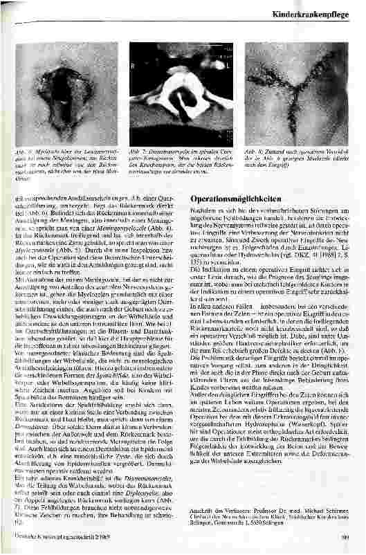 Vorschauseite 2: Spaltfehlbildungen an Wirbelsäule und Rückenmark