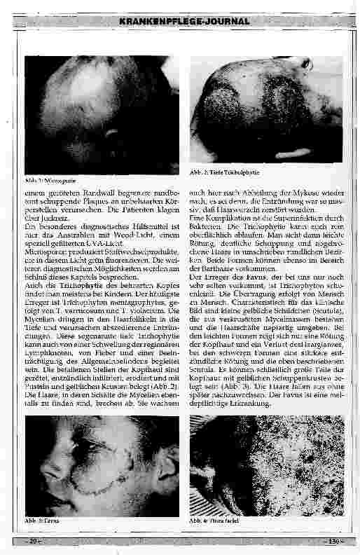 Vorschauseite 3: Ursachen, Klinik und Therapie von Mykosen