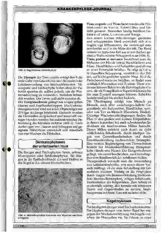 Vorschauseite 4: Ursachen, Klinik und Therapie von Mykosen