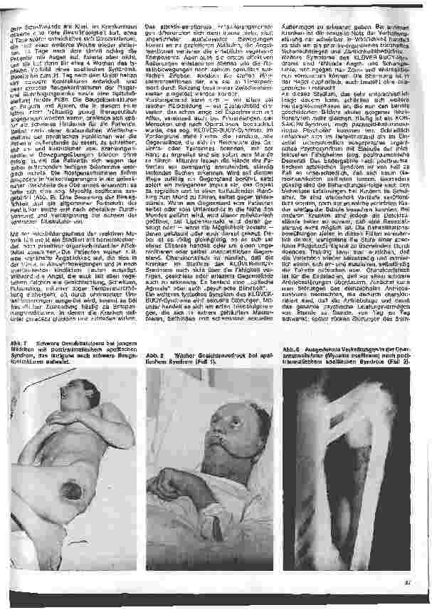 Vorschauseite 4: Die Schwester in der Psychiatrie 18. Folge: Das posttraumatische apallische Syndrom