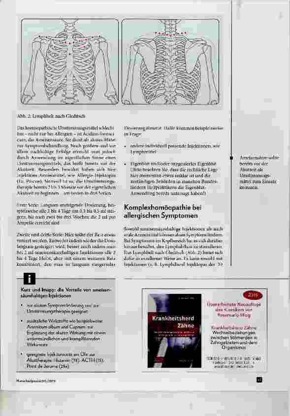 Vorschauseite 4: Allergien: Injektionen und Infusionen