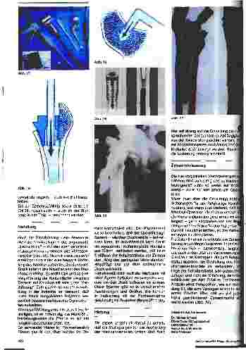 Vorschauseite 4: Fortschritte in der Zementiertechnik