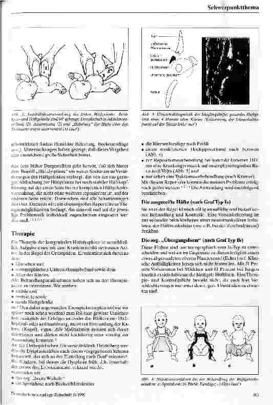 Vorschauseite 2: Die kongenitale Hüftdysplasie