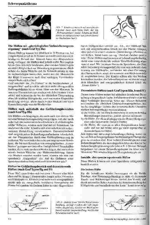Vorschauseite 3: Die kongenitale Hüftdysplasie