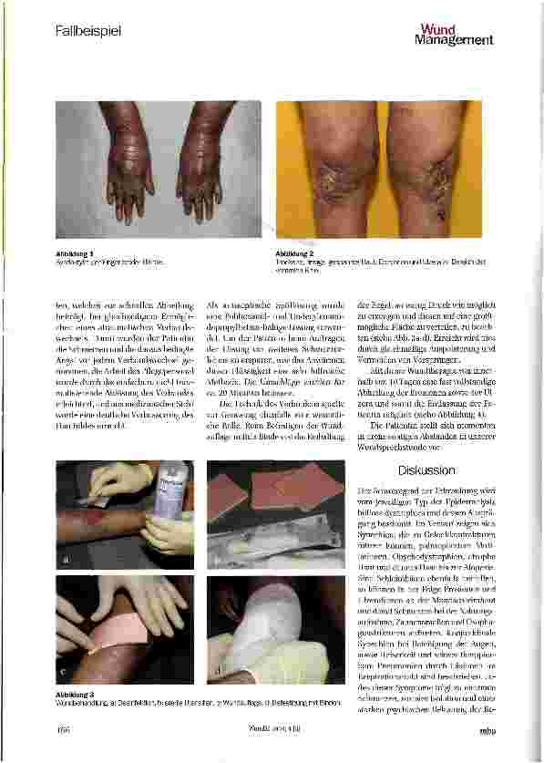 Vorschauseite 3: Atraumatische Wundbehandlung am Beispiel der Epidermolysis bullosa dystrophica