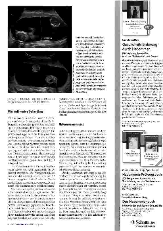 Vorschauseite 2: Blut bei Zwillingen ungleich verteilt