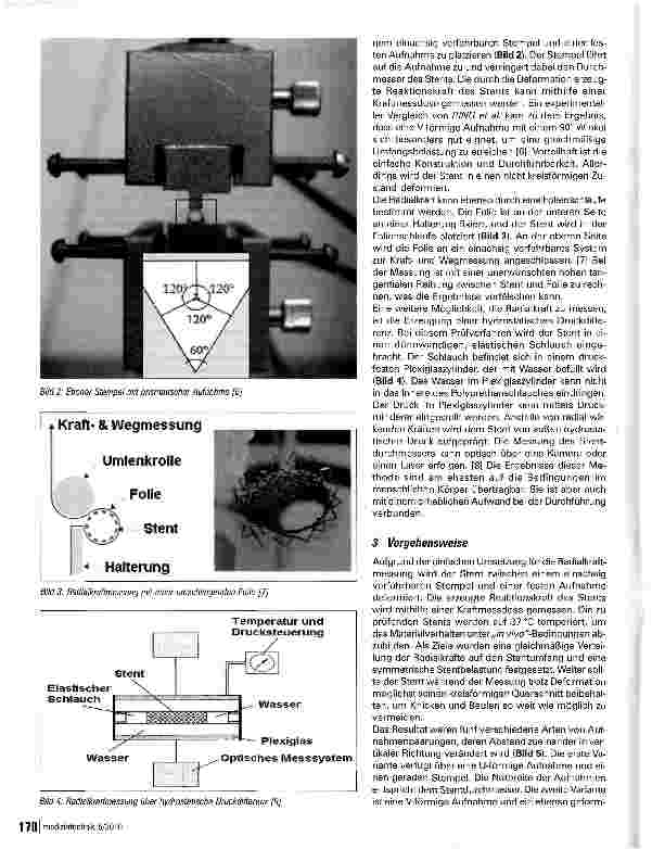 Vorschauseite 2: Radialkraftmessung von Nitinol-Stents