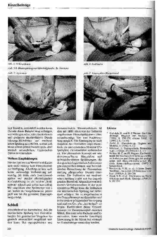 Vorschauseite 4: Mechanische Spülung bei Harnableitungen