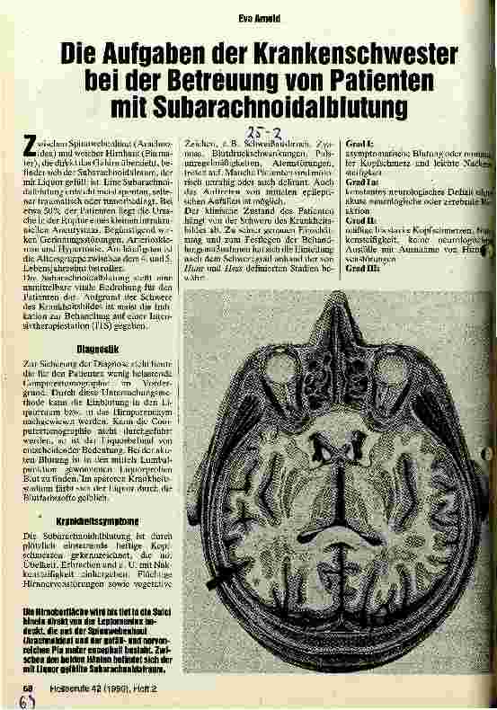 Vorschauseite 1: Die Aufgaben der Krankenschwester bei der Betreuung von Patienten mit Subrarachnoidalblutung