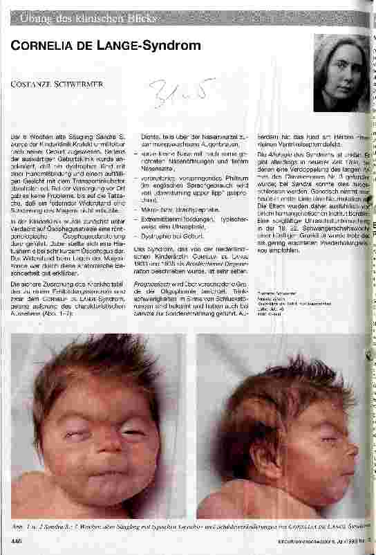 Vorschauseite 1: Cornelia de Lange-Syndrom