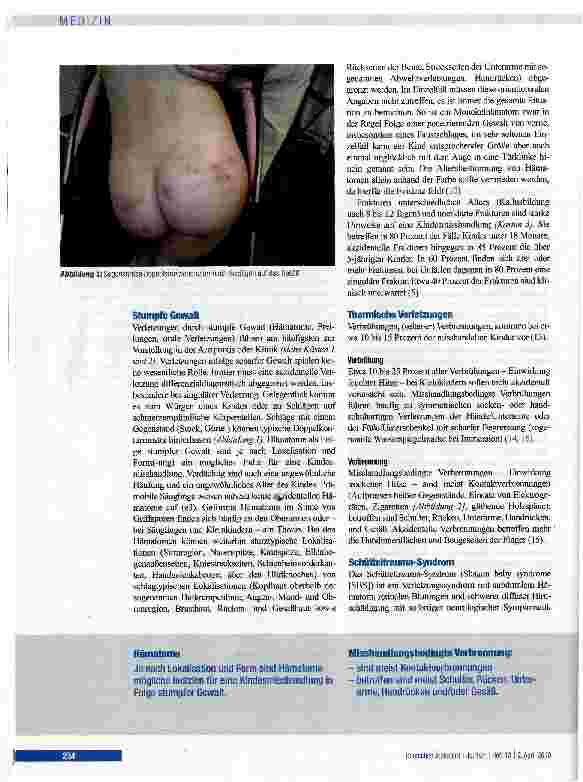Vorschauseite 4: Misshandlung und Vernachlässigung von Kindern - Diagnose und Vorgehen