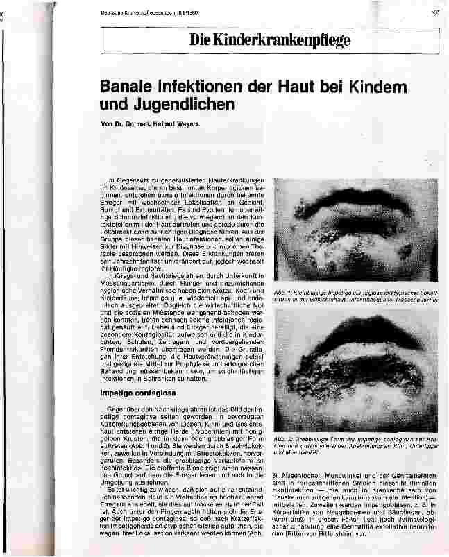 Vorschauseite 1: Banale Infektionen der Haut bei Kindern und Jugendlichen