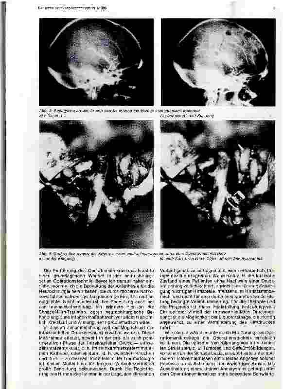 Vorschauseite 2: Ergebnisse moderner Neurochirurgie