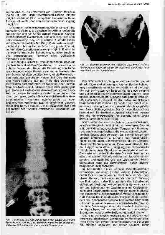 Vorschauseite 3: Ergebnisse moderner Neurochirurgie