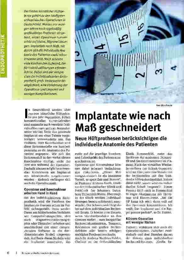Vorschauseite 1: Implantate wie nach Maß geschneidert