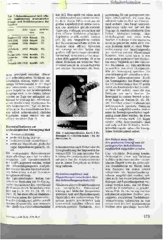 Vorschauseite 5: Pathogenese, operative Therapie und Rehabilitation der traumatischen ventralen Schulterluxation