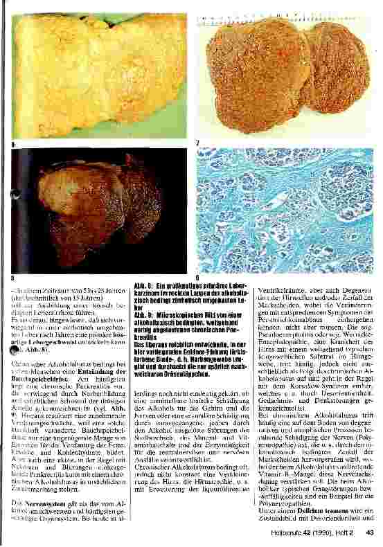 Vorschauseite 3: Alkoholmißbrauch und Alkoholismus - mögliche Organschäden und ihre Prognose