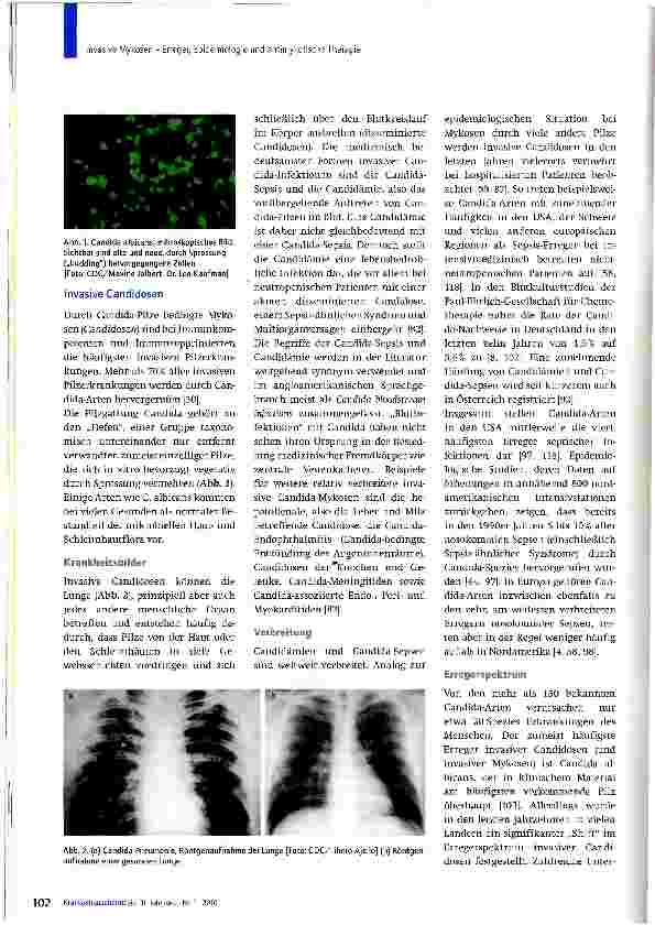 Vorschauseite 2: Invasive Mykosen - Erreger, Epidemiologie und antimykotische Therapie
