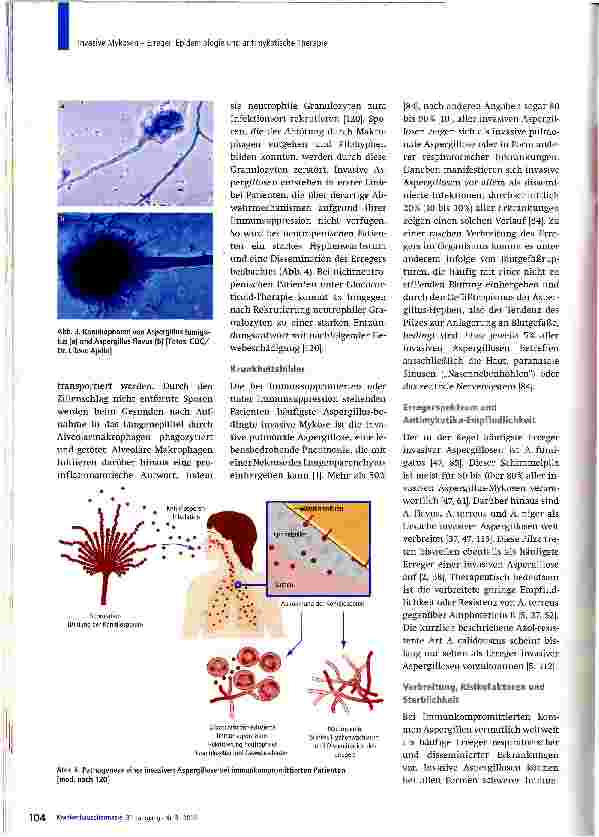 Vorschauseite 4: Invasive Mykosen - Erreger, Epidemiologie und antimykotische Therapie