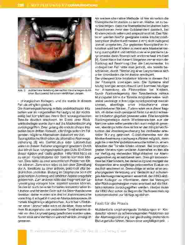 Vorschauseite 3: Schwierge endotracheale Intubation infolge oropharyngealer Verletzung bei einem vierjährigen Jungen