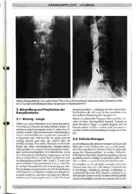 Vorschauseite 4: Ursachen, Klinik und Therapie der akuten idiopathischen Polyradikuloneuritis (Guillain-Barre-Syndrom)
