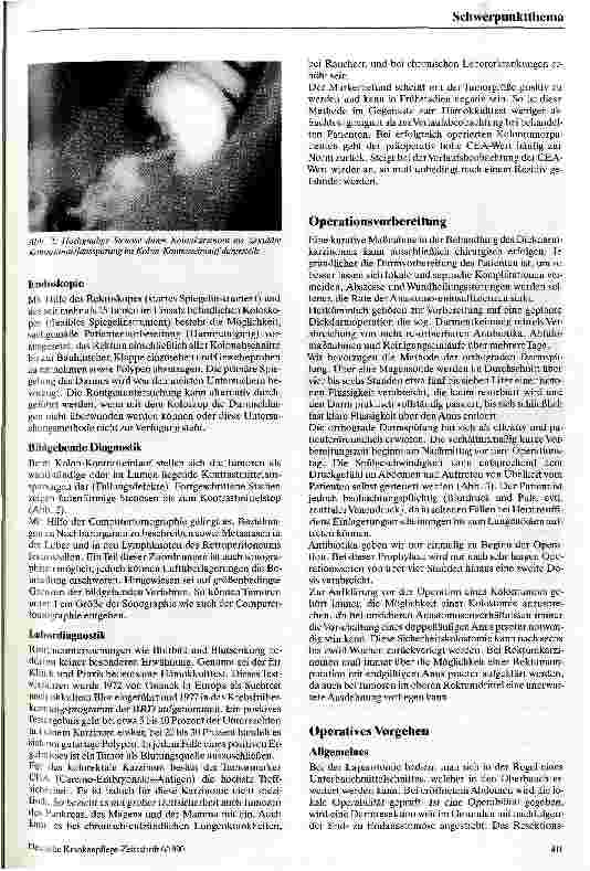 Vorschauseite 2: Tumorchirurgie des Dickdarmes