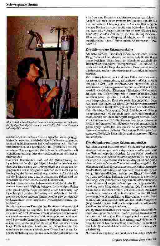 Vorschauseite 3: Tumorchirurgie des Dickdarmes