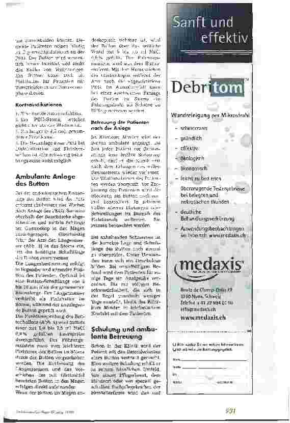 Vorschauseite 2: Alternative zur herkömmlichen PEG: der Button - Erste Erfahrungen mit dem Freka Button -