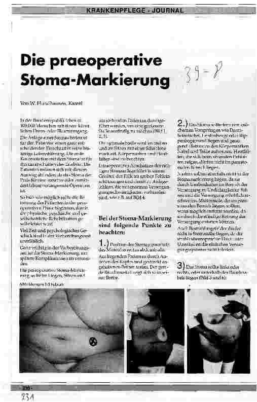 Vorschauseite 1: Die präoperative Stoma-Markierung