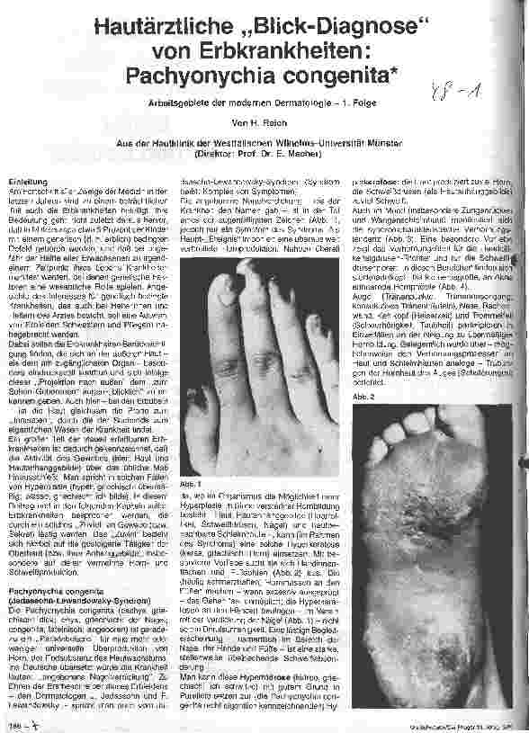 Vorschauseite 1: Hautärztliche Blick-Diagnose von Erbkrankheiten: Pachyonychia congenita - Moderne Dermatologie - 1. Folge