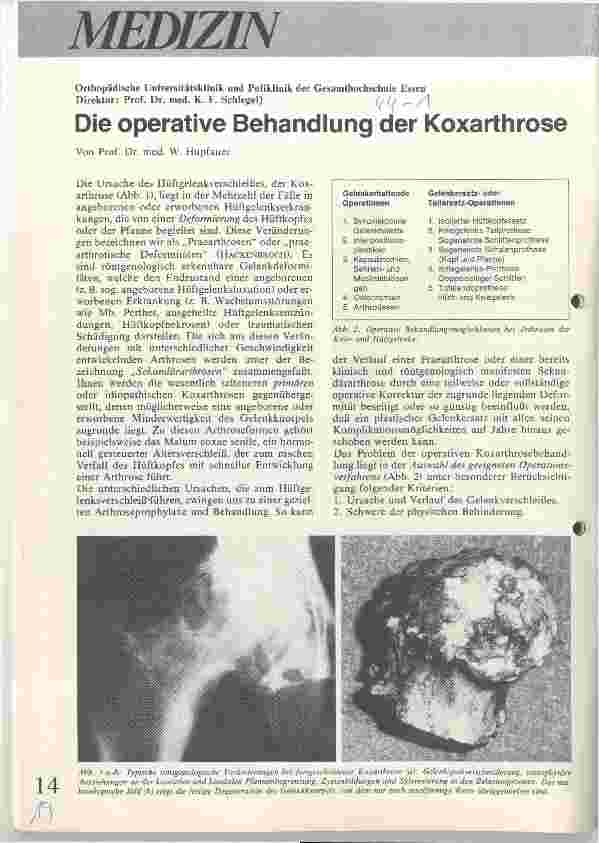 Vorschauseite 1: Die operative Behandlung der Koxarthrose