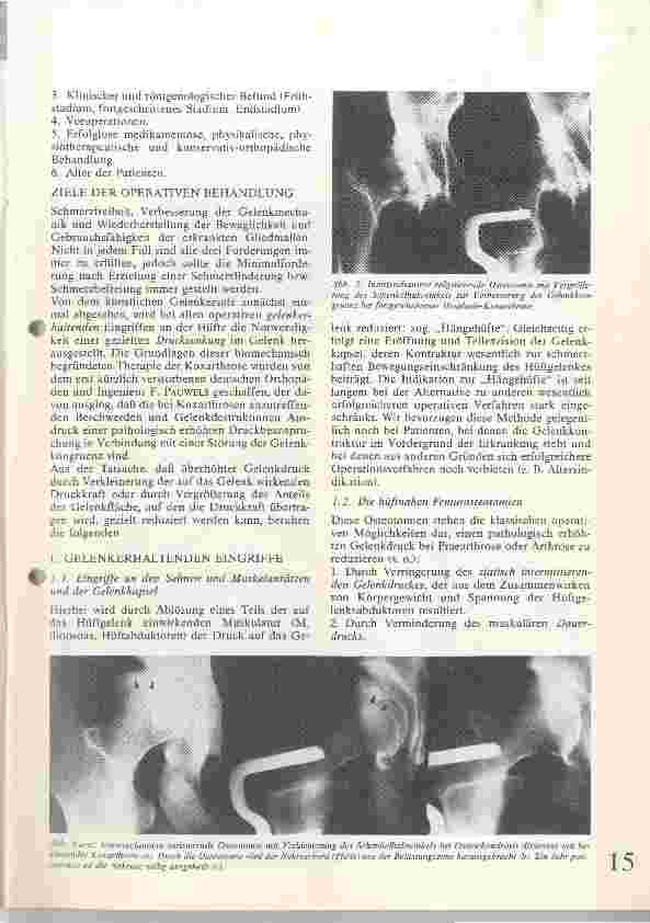 Vorschauseite 2: Die operative Behandlung der Koxarthrose