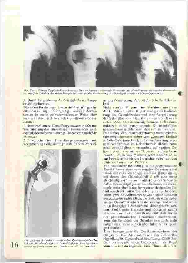 Vorschauseite 3: Die operative Behandlung der Koxarthrose