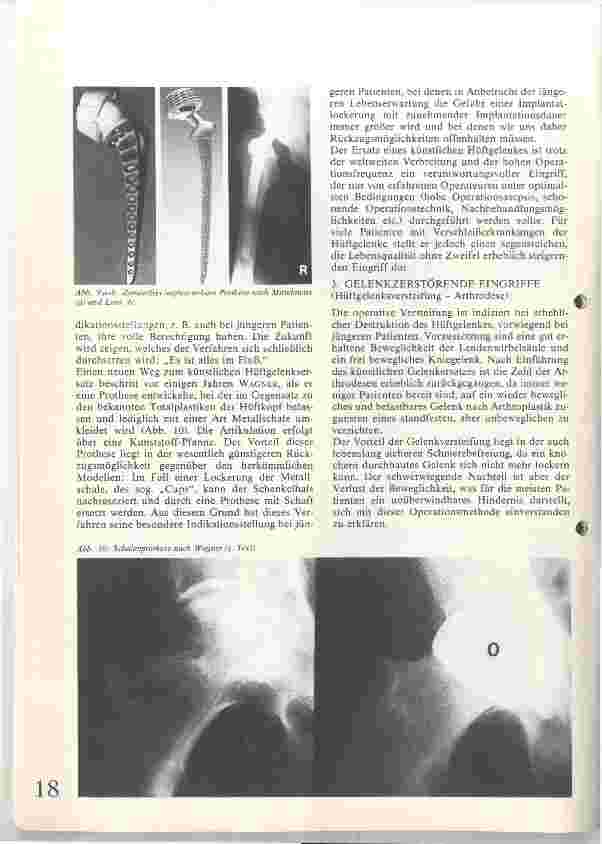 Vorschauseite 5: Die operative Behandlung der Koxarthrose