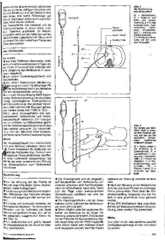 Vorschauseite 2: Pflege in Therapie und Diagnostik 6. Folge: Zentraler Venendruck und Flüssigkeitsbilanzierung