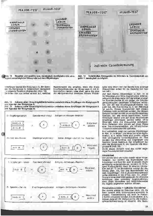Vorschauseite 5: Transfusionskunde, Blutgruppenserologie und Immunhämatologie 15. Folge