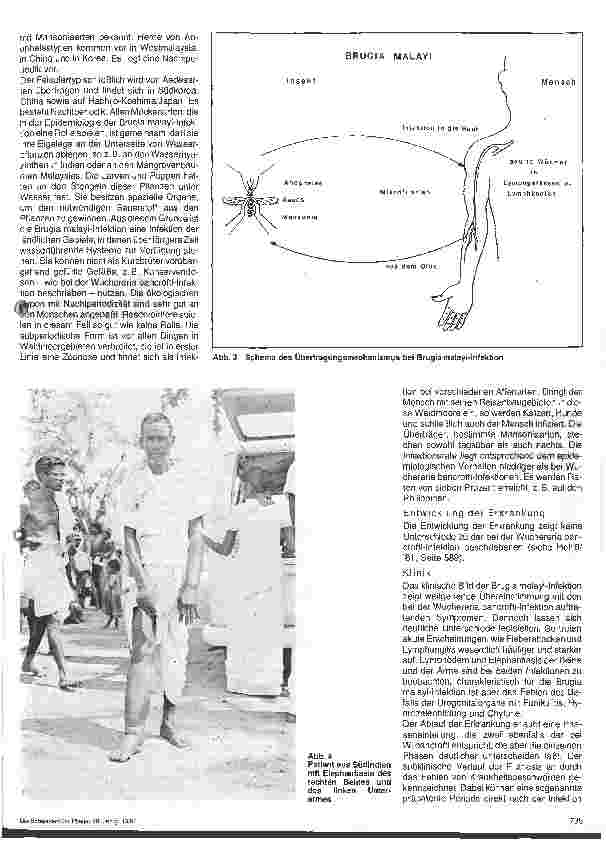 Vorschauseite 2: Wurminfektion - Filariasis