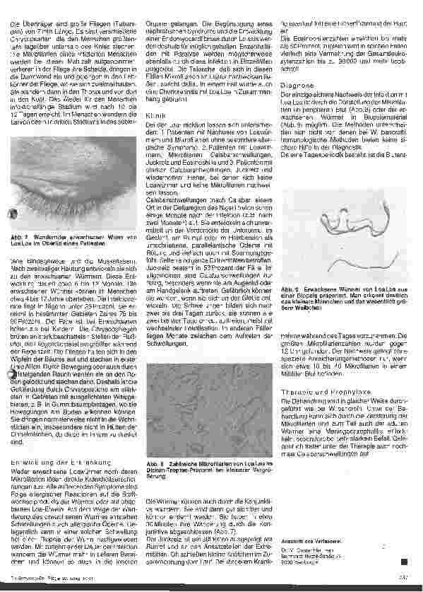 Vorschauseite 4: Wurminfektion - Filariasis