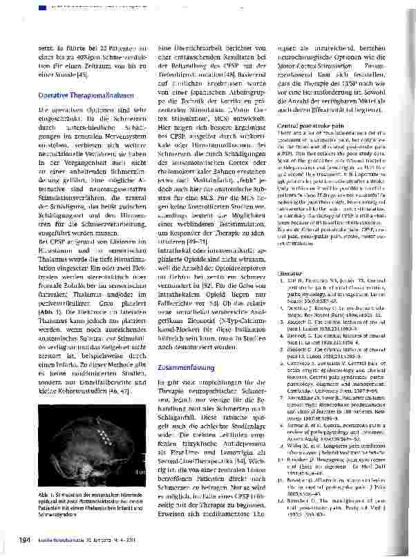 Vorschauseite 4: „Zentrale Schmerzen nach Schlaganfall -eine therapeutische Herausforderung