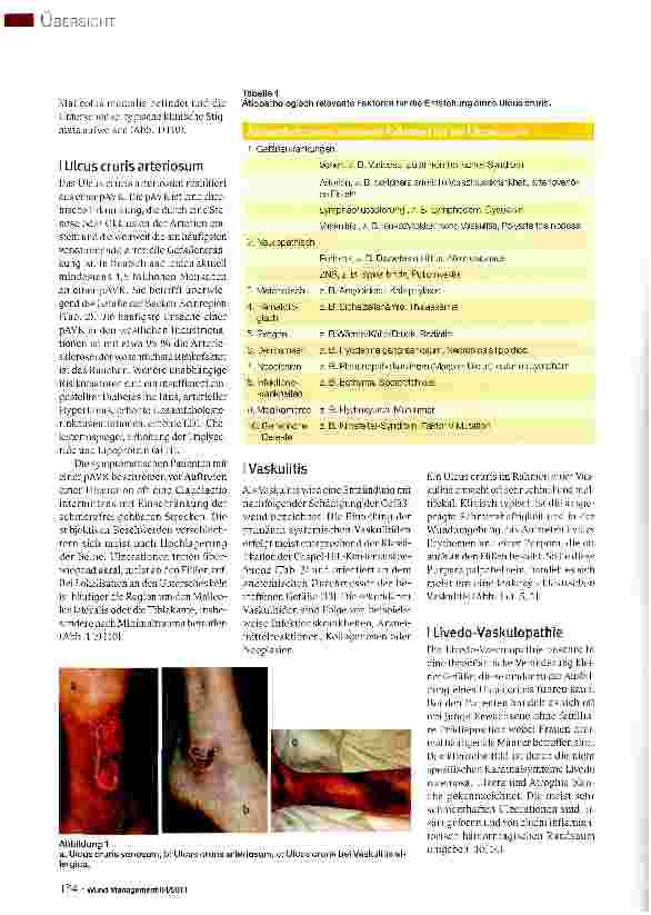 Vorschauseite 2: Genese des Ulcus cruris