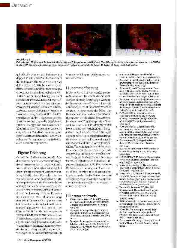 Vorschauseite 3: Biochirurgie mit Maden