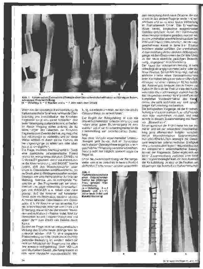 Vorschauseite 2: Die Bedeutung der Pathophysiologie und Biomechanik für die Frakturheilung