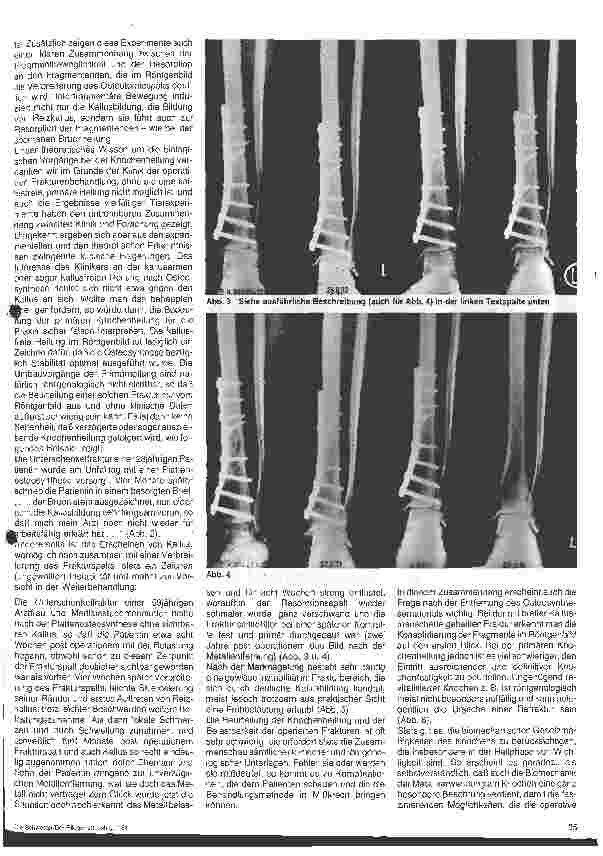 Vorschauseite 3: Die Bedeutung der Pathophysiologie und Biomechanik für die Frakturheilung