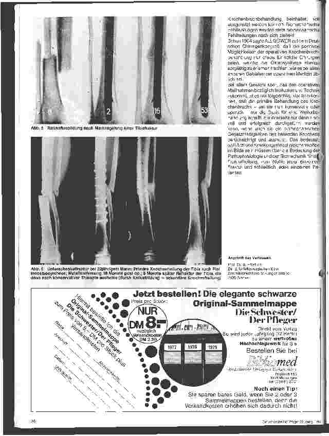 Vorschauseite 4: Die Bedeutung der Pathophysiologie und Biomechanik für die Frakturheilung