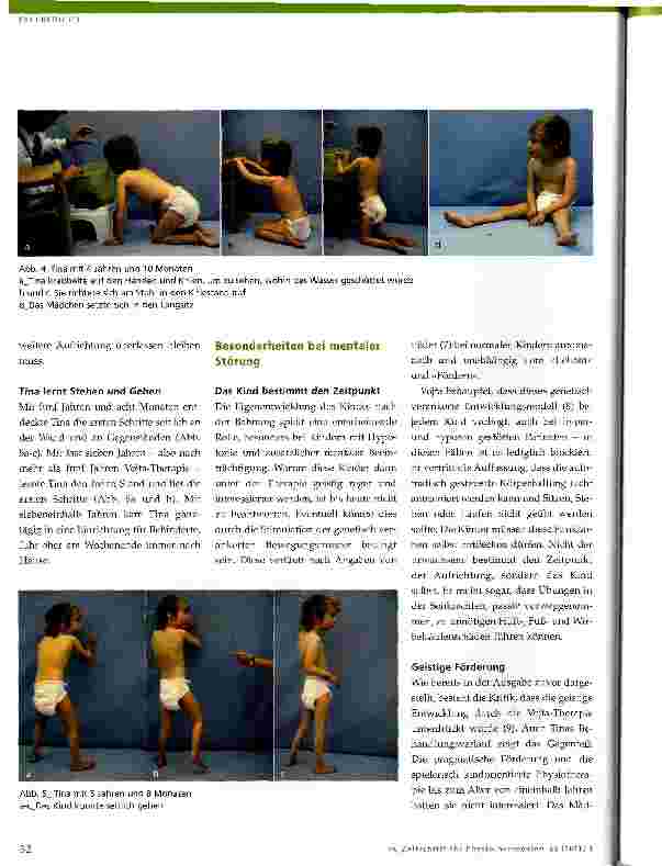 Vorschauseite 4: Physiotherapie bei neurologisch bedingten Bewegungsstörungen im KindesalterBehandlungsverlauf eines Kindes mit Hypotonie und mentaler Beeinträchtigung