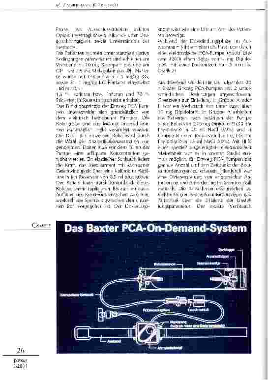 Vorschauseite 2: Postoperative Schmerztherapie mit Einweg PCA-Pumpen und titriertem Bolus