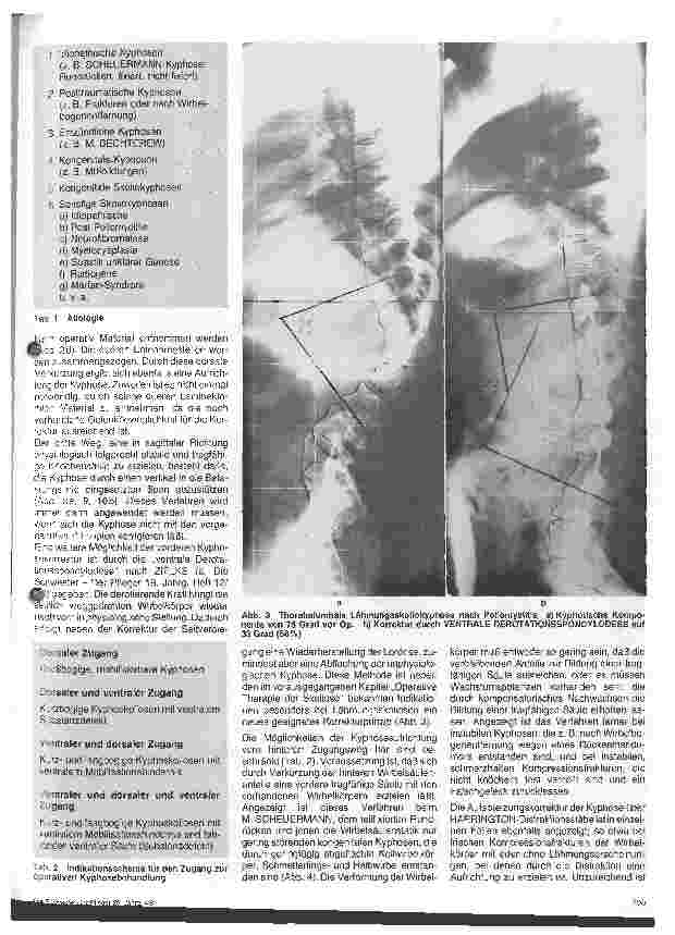 Vorschauseite 2: Operative Therapie der Kyphose