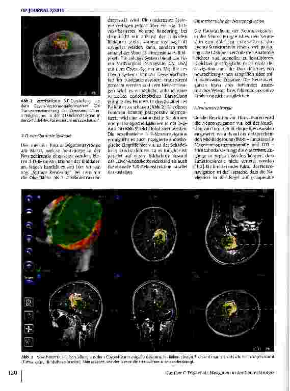 Vorschauseite 3: Navigation in der Neurochirurgie
