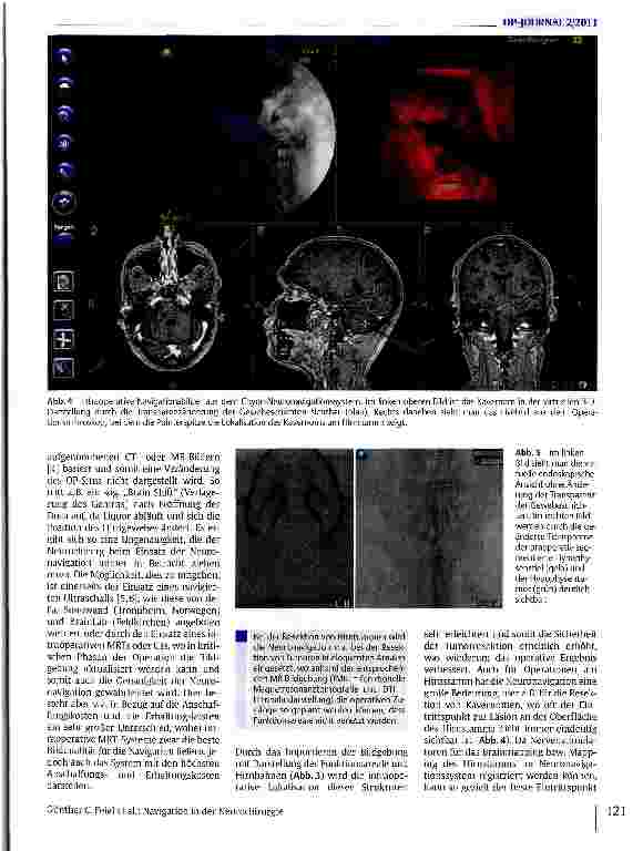 Vorschauseite 4: Navigation in der Neurochirurgie